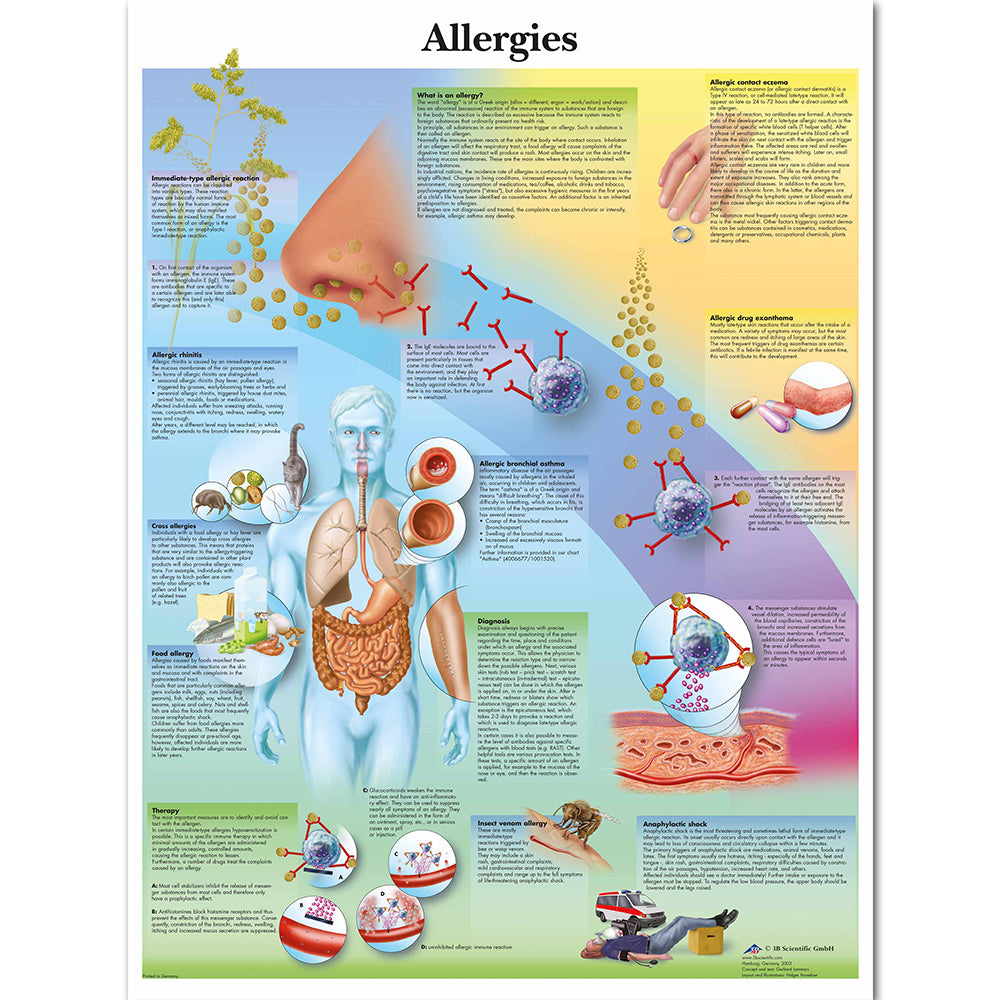 Allergies Chart Poster