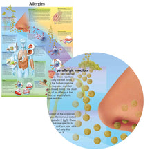 Load image into Gallery viewer, Allergies Chart Poster