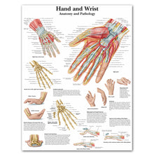 Load image into Gallery viewer, Hand Wrist Anatomy and Pathology Poster