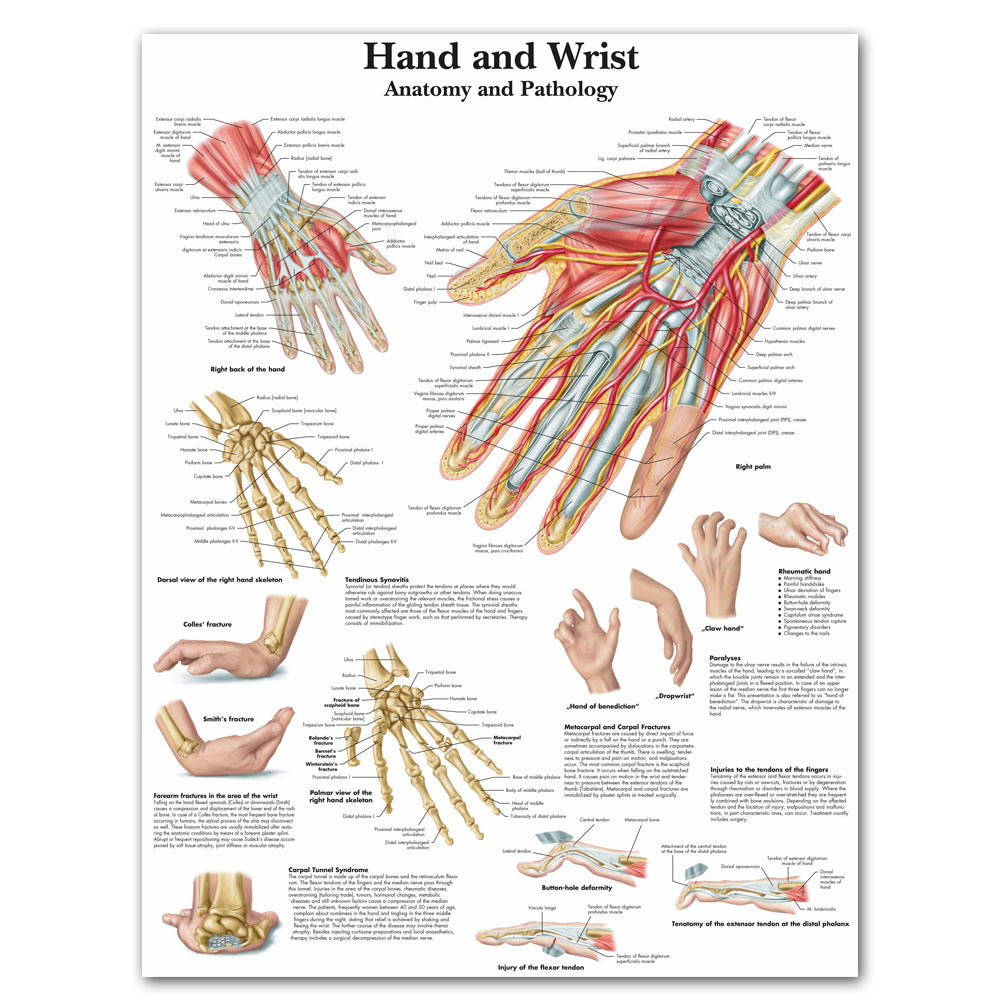 Hand Wrist Anatomy and Pathology Poster