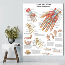Load image into Gallery viewer, Hand Wrist Anatomy and Pathology Poster