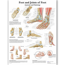 Load image into Gallery viewer, Foot and Joint Anatomy and Pathology Poster