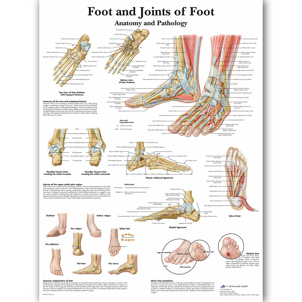 Foot and Joint Anatomy and Pathology Poster