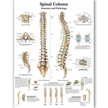 Load image into Gallery viewer, Spinal Column Anatomy and Pathology Poster