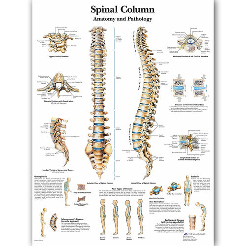 Spinal Column Anatomy and Pathology Poster