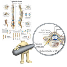 Load image into Gallery viewer, Spinal Column Anatomy and Pathology Poster