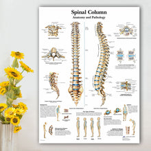 Load image into Gallery viewer, Spinal Column Anatomy and Pathology Poster